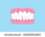 Full mouth teeth - Crossbite illustration vector design. Dental care concept.