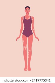 A full-length figure of a young Hispanic woman in a swimsuit with vitiligo. Body positive. Love yourself. Vector flat illustration