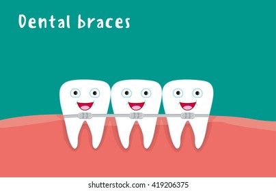 Fun illustration of dental braces for children