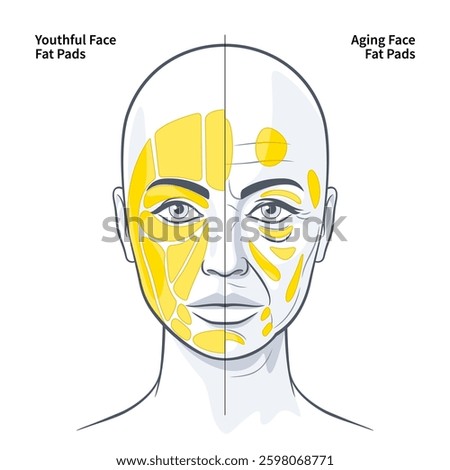 The Functional Anatomy of the Superficial Fat Pads Youthful and Aging Face vector illustration