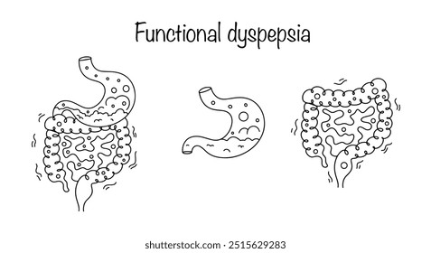 Dispepsia funcional. Distúrbios digestivos nos quais os processos de fermentação e putrefação predominam nos intestinos. A fermentação também pode ocorrer no estômago. Ilustração vetorial.