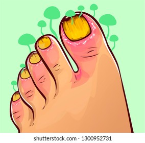 Fungal Infections, vector illustration