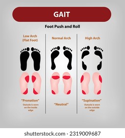 Gait is the pattern of walking or foot walking style of a particular person Vector and illustration, Low arch, high arch, Normal Arch