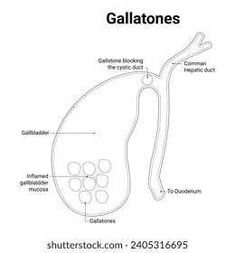 Gallatones Science Design Vector Illustration Diagram