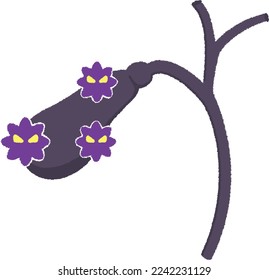 Gallbladder cancer A malignant tumor that develops in the gallbladder or gallbladder duct is called gallbladder cancer.