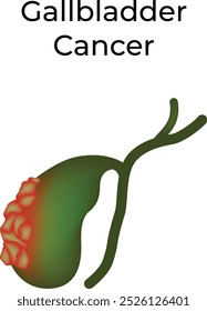 Gallbladder Cancer Science Vector Illustration 