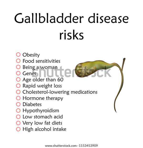 Gallbladder Disease Risks Inflammation Gallstones Cholecystitis Stock ...
