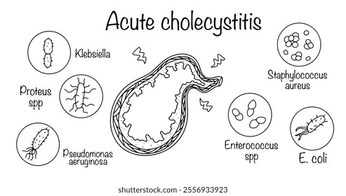 Gallbladder disease, which is associated with the development of inflammation. A simple illustration of the gallbladder and the main sources of infection. Isolated vector on white background.