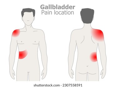 Gallbladder pain, attack location. Stones, cancer, polyps, tumors, blockages. Right upper abdomen, shoulder region, referred. Front, back region. Characteristics related symptoms. Illustration vector