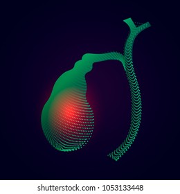 Gallbladder with a point of pain. Stylized transition from a real organ to an X-ray effect. Medical illustration of Gallbladder disease