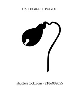 Gallbladder Polyps Concept. Inflammation In The Digestive System. Human Internal Organ Examination In Clinic Or Hospital. Abdominal Pain, Diagnosis And Treatment. Medical Flat Vector Illustration.