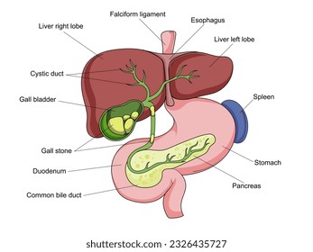 Gallstone structure stone gallbladder diagram schematic vector illustration. Medical science educational illustration