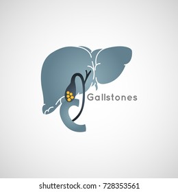 Gallstone Vector Logo Icon Illustration