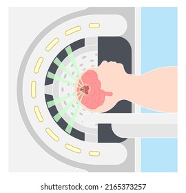 Gamma Tumor Cancer Treat Exam Body X-ray MRI Imaging Scan Medicine Focus Disease Accelerator Central Nervous System Beam CT Linac Linear Particle Oncology Knife Minimally Invasive