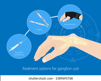 Ganglion cyst small sac of fluid disease hand wrist trauma joint tendon