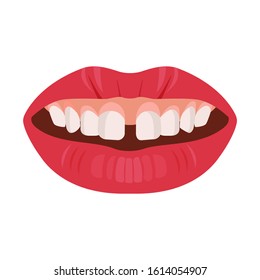 Gap teeth concept. Dental tooth problem and treatment. Dentistry care. Vector