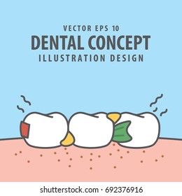 Garbage stucking teeth illustration vector on blue background. Dental concept.