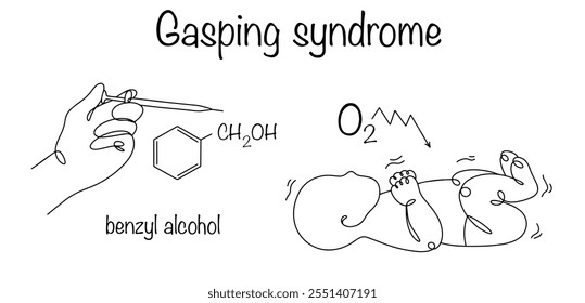 Gasping-Syndrom Gefährlicher Zustand von Neugeborenen, begleitet von Asphyxie. Das Gasping-Syndrom tritt aufgrund der toxischen Wirkungen von Benzylalkohol während medizinischer Eingriffe auf. Von Hand gezeichnetes Krankheitsdiagramm.