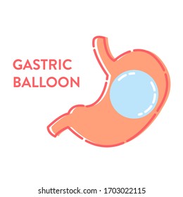 Gastric balloon non surgical weight loss procedure in stomach. Medical concept. Human body organ anatomy and health care. Vector illustration in flat style.