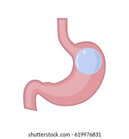 Gastric balloon stomach. Vector illustration flat design svg
