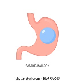 Gastric balloon weight loss intragastric surgery. Stomach gastric balloon operation vector icon svg
