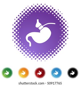 Gastric Bypass