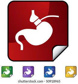 Gastric Bypass