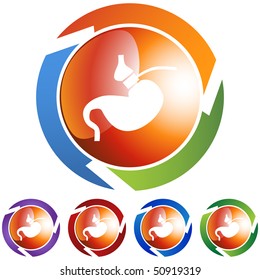 Gastric Bypass