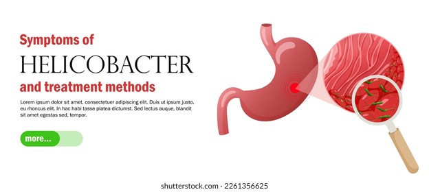 Gastritis and helicobacter pylori web banner template. Healthcare vector illustration cartoon style
