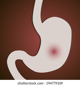 Gastritis or stomach ulcers poster on red gradient background poster