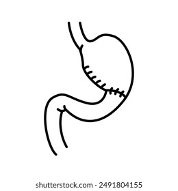 Gastroduodenostomy line black icon. Sign for web page, mobile app, button, logo. Vector isolated button. Editable stroke.