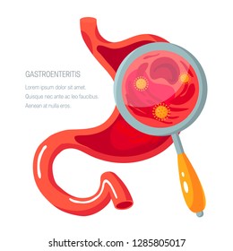 Gastroenteritis Bilder Stockfotos Und Vektorgrafiken Shutterstock