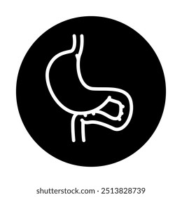 Gastroenterostomy black line icon. Operations on the abdominal cavity. Vector isolated element. 