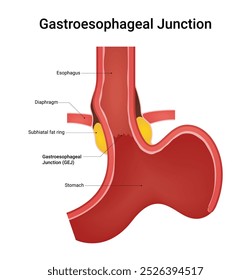 Junção Gastresofágica (GEJ) e Visão Geral