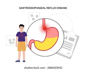 Gastroesophageal Reflux Disease Child Clinic Digestive Stock Vector ...