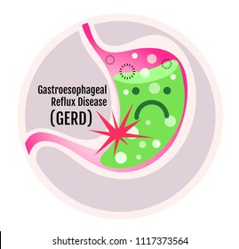 Gastroesophageal Reflux Disease (GERD), Acidity, Upset, Pain, And Sad Stomach Vector Cartoon.