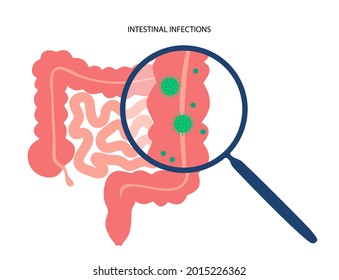 Gastrointestinal Infections Concept. Viral, Bacterial Or Parasitic Infection In Intestine. Gastroenteritis, Inflammation Of The Digestive System. Diarrhea, Vomiting, And Abdominal Pain In Human Body.