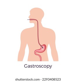 Gastroscopy diagnostics examination flat concept vector illustration
