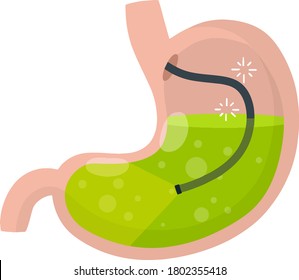 Gastroscopy. Endoscopy and digestive problems. Hose with camera. Procedure with internal organs. Cartoon flat illustration. Medical Visual inspection of stomach