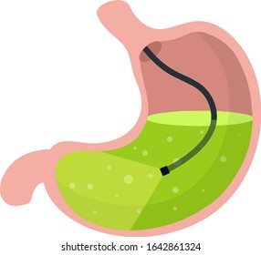 Gastroscopy. Medical Visual inspection of stomach. Endoscopy and digestive problems. Hose with camera. Procedure with internal organs. Cartoon flat illustration