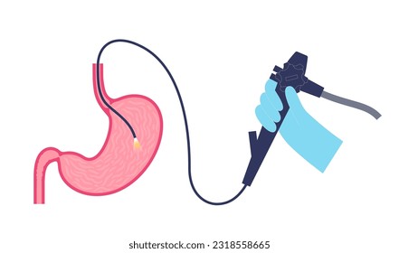 Gastroscopy procedure. Gastroenterologist uses a gastroscope. Stomach and duodenum diagnostic. Gastroenterology, endoscopy and gastrointestinal disease. Digestive system infection and treatment vector