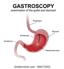 Gastroscopy, a study of the esophagus and stomach using an endoscope, diagnosis of diseases of the digestive system of humans