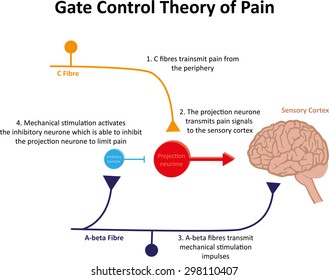 Gate Control Theory of Pain Illustration