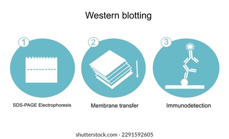 Der allgemeine Workflow der Western-Blot-Technik: SDS-PAGE-Elektrophorese, Membranübertragung und Immunodetektion, die in blau und weiß von Symbolkonzepten dargestellt sind.