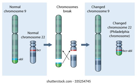 Genetic abnormality of chromosome 22, a factor in chronic myeloid leukemia.