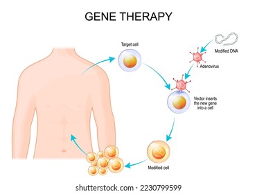 Genetic engineering. Gene therapy using an adenovirus vector. virus inserts the new gene into a cell, that will make proteins to treat a disease. vector illustration