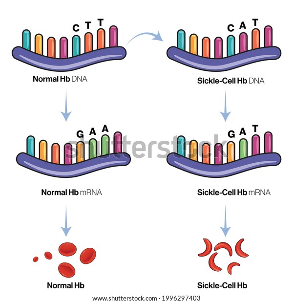 Genetic Mechanism Genetics Sickle Cell Anemia Stock Vector (Royalty ...