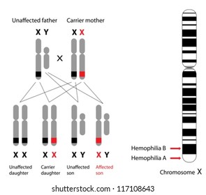 Genetics Of Hemophilia, A And B