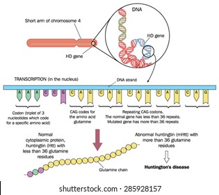 Genetics Of Huntingtons Disease, Showing Chromosome 4, The HD Gene And Repeating CAG Codons Resulting In Excessive Glutamine Chain