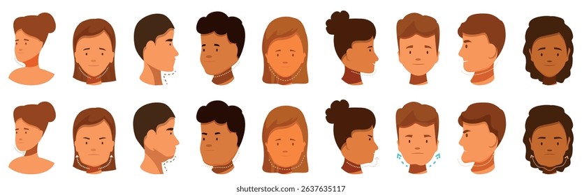 Genioplasty icons set. Various stages of neck pain and relief depicted in a series of illustrations